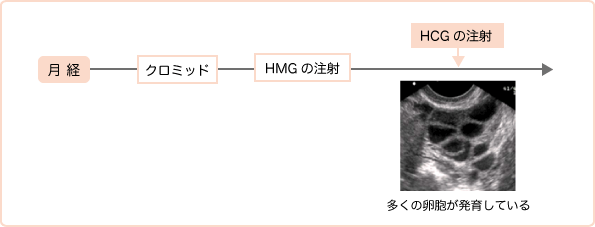 排卵誘発法