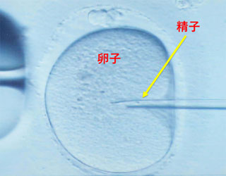 図2